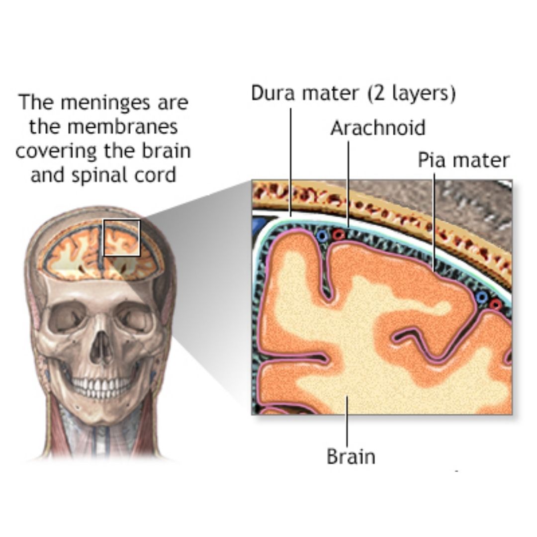 Meningitis TB